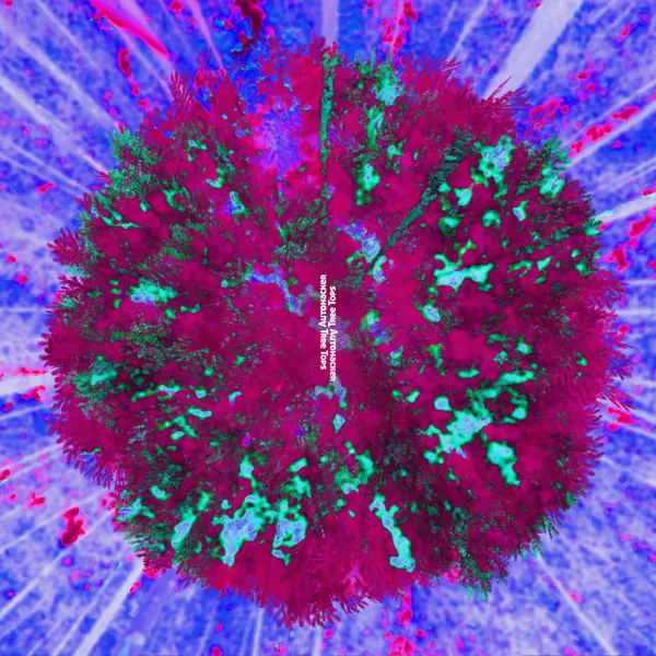 Release Tree Tops Single Epidemic Sound